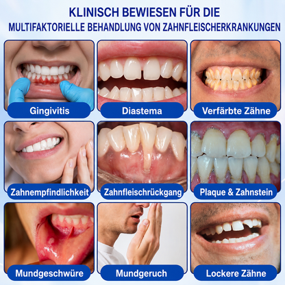 🦷🦢Healrize® GumRevive Gel zur Regeneration des Zahnhalteapparats (bei Zahnfleischbluten, Zahnfleischrückgang und lockeren Zähnen)🦷