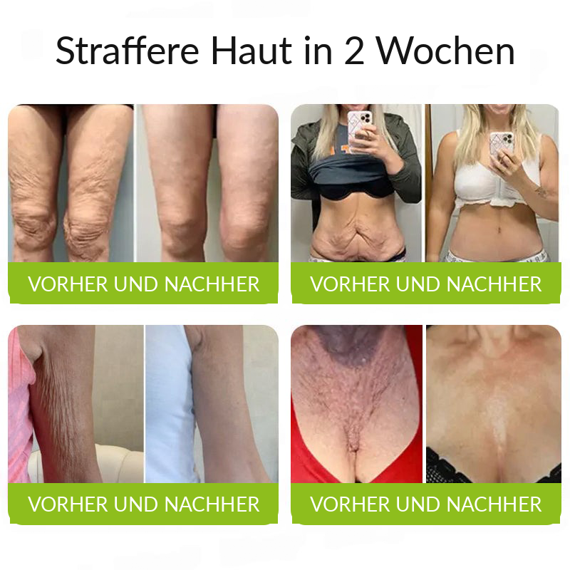 Hergestellt und versandt aus den DE 👉 💝 Healrize® Botox & Vita-A Retinol Shot – Straffende Creme gegen Falten (Wrinkle-Lift) – Aktion am letzten Tag: 60 % Rabatt 💝