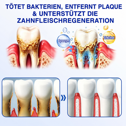 🦷🦢Healrize® GumRevive Gel zur Regeneration des Zahnhalteapparats (bei Zahnfleischbluten, Zahnfleischrückgang und lockeren Zähnen)🦷