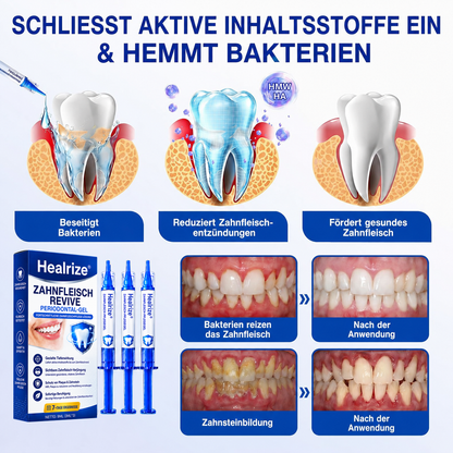 🦷🦢Healrize® GumRevive Gel zur Regeneration des Zahnhalteapparats (bei Zahnfleischbluten, Zahnfleischrückgang und lockeren Zähnen)🦷