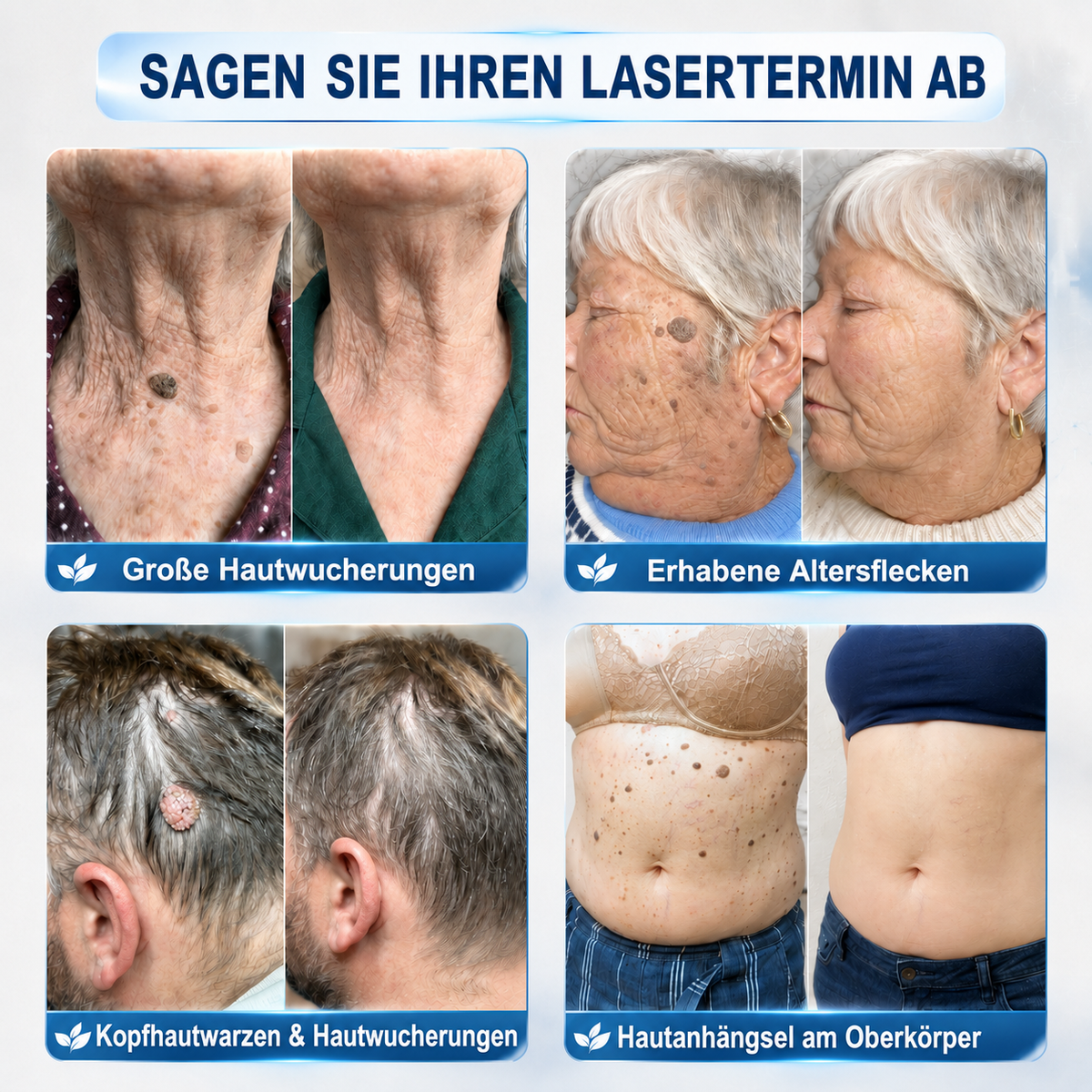 Healrize® 7-Tage Hautmal- & Flecken-Entferner 🐰(Schmerzfrei, Narbenfrei mit Rollball-Applikator)🐰