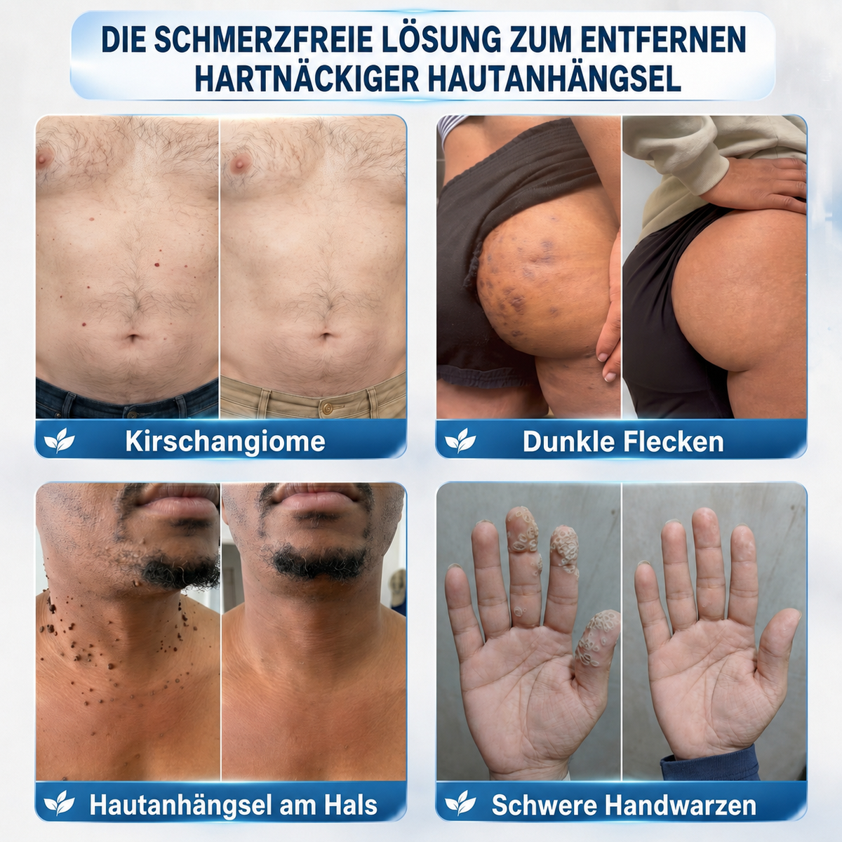 Healrize® 7-Tage Hautmal- & Flecken-Entferner 🐰(Schmerzfrei, Narbenfrei mit Rollball-Applikator)🐰